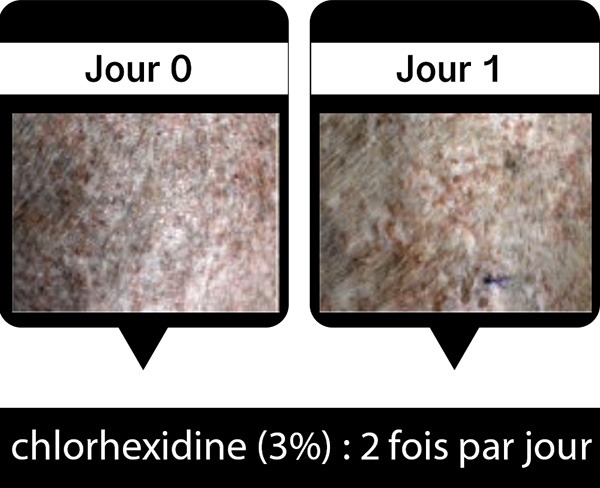 Traitement à la Chlorhexidine inefficace du chien Baloo